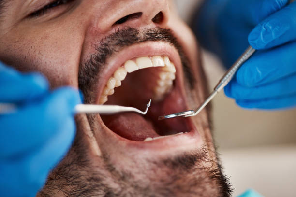 Best Urgent Care for Lost Fillings or Crowns in Wayne, WV